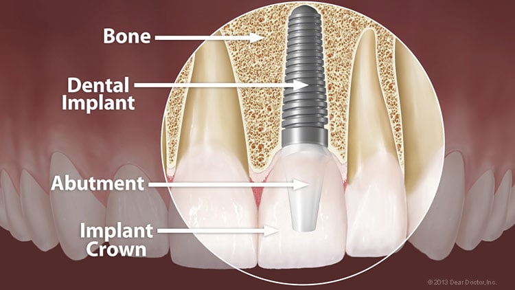 Preventive Dental Services PC - Homer, AK, US, teeth whitening