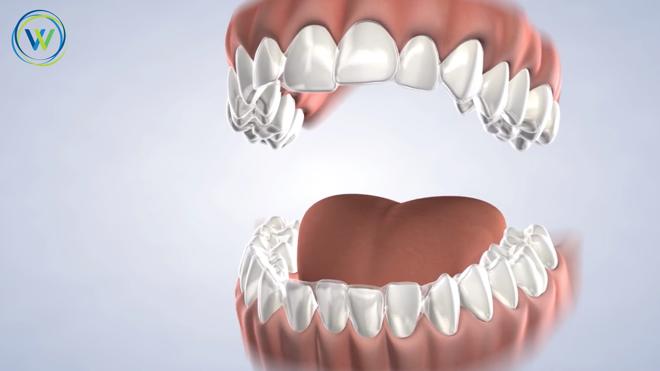 Winterholler Dentistry: Payson Dental Care, US, teeth straightening
