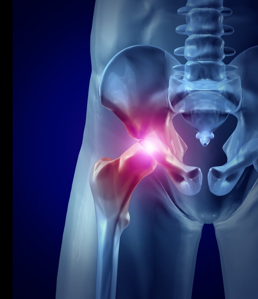 QC Kinetix (Asheville), US, hip replacement alternatives