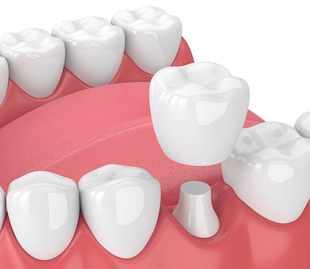 Mauka Family Dental - Mililani, HI, US, toothache relief